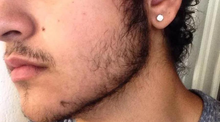 First and Foremost, Be Patient for beard growth