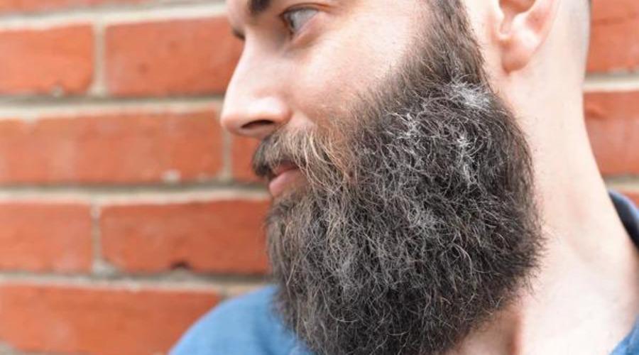 Leczenie łupieżu brody